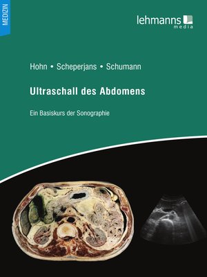 cover image of Ultraschall des Abdomens
